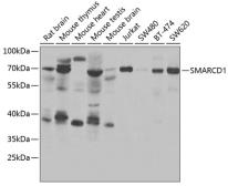 Anti-SMARCD1 antibody used in Western Blot (WB). GTX33507