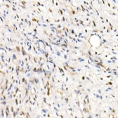 Anti-SNF5 antibody used in IHC (Paraffin sections) (IHC-P). GTX33509
