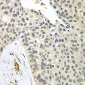 Anti-SNRPD2 antibody used in IHC (Paraffin sections) (IHC-P). GTX33510