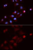 Anti-SNRPE antibody used in Immunocytochemistry/ Immunofluorescence (ICC/IF). GTX33511