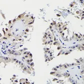 Anti-SNRPE antibody used in IHC (Paraffin sections) (IHC-P). GTX33511