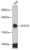 Anti-SOCS1 antibody used in Western Blot (WB). GTX33512