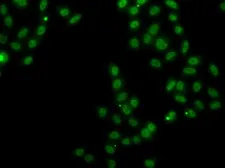 Anti-SOX5 antibody used in Immunocytochemistry/ Immunofluorescence (ICC/IF). GTX33514