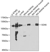 Anti-SOX6 antibody used in Western Blot (WB). GTX33515
