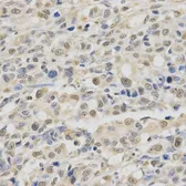 Anti-SPHK1 antibody used in IHC (Paraffin sections) (IHC-P). GTX33516