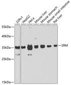 Anti-SRM antibody used in Western Blot (WB). GTX33518