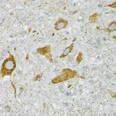 Anti-ST3GAL3 antibody used in IHC (Paraffin sections) (IHC-P). GTX33520