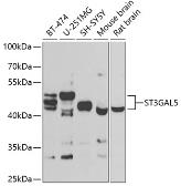 Anti-ST3GAL5 antibody used in Western Blot (WB). GTX33521
