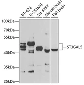 Anti-ST3GAL5 antibody used in Western Blot (WB). GTX33521