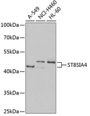 Anti-ST8SIA4 antibody used in Western Blot (WB). GTX33523