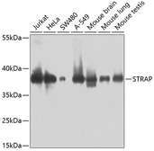 Anti-STRAP antibody used in Western Blot (WB). GTX33528