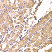Anti-Suppressor of Fused antibody used in IHC (Paraffin sections) (IHC-P). GTX33530