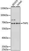 Anti-TAP1 antibody used in Western Blot (WB). GTX33534