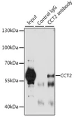 Anti-TCP1 beta antibody used in Immunoprecipitation (IP). GTX33535