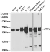 Anti-TCP1 epsilon antibody used in Western Blot (WB). GTX33537