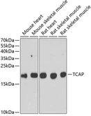 Anti-Telethonin antibody used in Western Blot (WB). GTX33540
