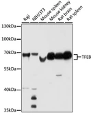 Anti-TFEB antibody used in Western Blot (WB). GTX33541