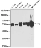 Anti-TFG antibody used in Western Blot (WB). GTX33542