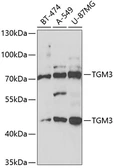 Anti-TGM3 antibody used in Western Blot (WB). GTX33543
