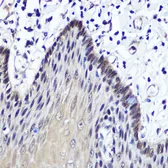 Anti-Thymidine Kinase 1 antibody used in IHC (Paraffin sections) (IHC-P). GTX33544