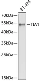 Anti-TIA1 antibody used in Western Blot (WB). GTX33545
