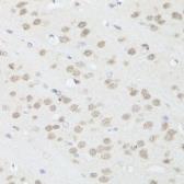Anti-TIA1 antibody used in IHC (Paraffin sections) (IHC-P). GTX33545