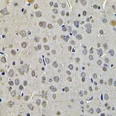 Anti-TID1 antibody used in IHC (Paraffin sections) (IHC-P). GTX33546