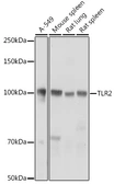 Anti-TLR2 antibody used in Western Blot (WB). GTX33547