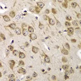 Anti-TMP21 antibody used in IHC (Paraffin sections) (IHC-P). GTX33548