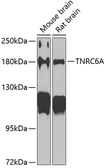 Anti-TNRC6A antibody used in Western Blot (WB). GTX33551