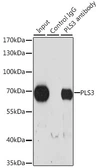 Anti-T-Plastin antibody used in Immunoprecipitation (IP). GTX33552