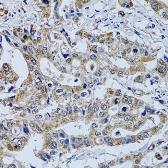 Anti-TPPP3 antibody used in IHC (Paraffin sections) (IHC-P). GTX33554