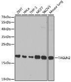 Anti-Transgelin 2 antibody used in Western Blot (WB). GTX33556