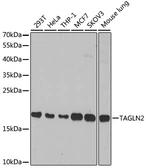 Anti-Transgelin 2 antibody used in Western Blot (WB). GTX33556