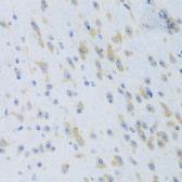 Anti-Prealbumin antibody used in IHC (Paraffin sections) (IHC-P). GTX33557