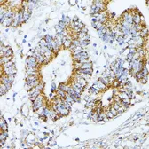 Anti-TRAP1 antibody used in IHC (Paraffin sections) (IHC-P). GTX33558