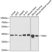 Anti-TWF2 antibody used in Western Blot (WB). GTX33562
