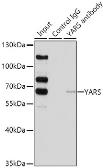 Anti-Tyrosyl tRNA synthetase antibody used in Immunoprecipitation (IP). GTX33565