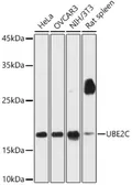 Anti-UBE2C antibody used in Western Blot (WB). GTX33567
