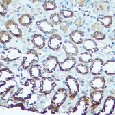 Anti-UQCRFS1 antibody used in IHC (Paraffin sections) (IHC-P). GTX33574