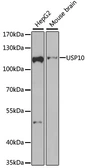 Anti-USP10 antibody used in Western Blot (WB). GTX33575