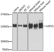 Anti-USP25 antibody used in Western Blot (WB). GTX33576