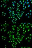 Anti-VDP / p115 antibody used in Immunocytochemistry/ Immunofluorescence (ICC/IF). GTX33578