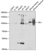 Anti-Villin antibody used in Western Blot (WB). GTX33579