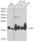 Anti-Visinin-like 1 antibody used in Western Blot (WB). GTX33580
