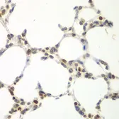 Anti-VRK1 antibody used in IHC (Paraffin sections) (IHC-P). GTX33581