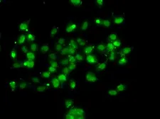 Anti-WBSCR22 antibody used in Immunocytochemistry/ Immunofluorescence (ICC/IF). GTX33582
