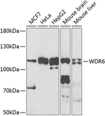 Anti-WDR6 antibody used in Western Blot (WB). GTX33583