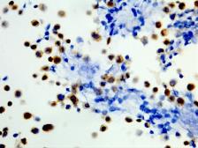 Anti-B-Raf (V600E Mutant Specific) antibody [RM8] used in IHC (Paraffin sections) (IHC-P). GTX33595