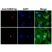 Anti-Histone H2B (phospho Ser14) antibody [RM238] used in Immunocytochemistry/ Immunofluorescence (ICC/IF). GTX33598